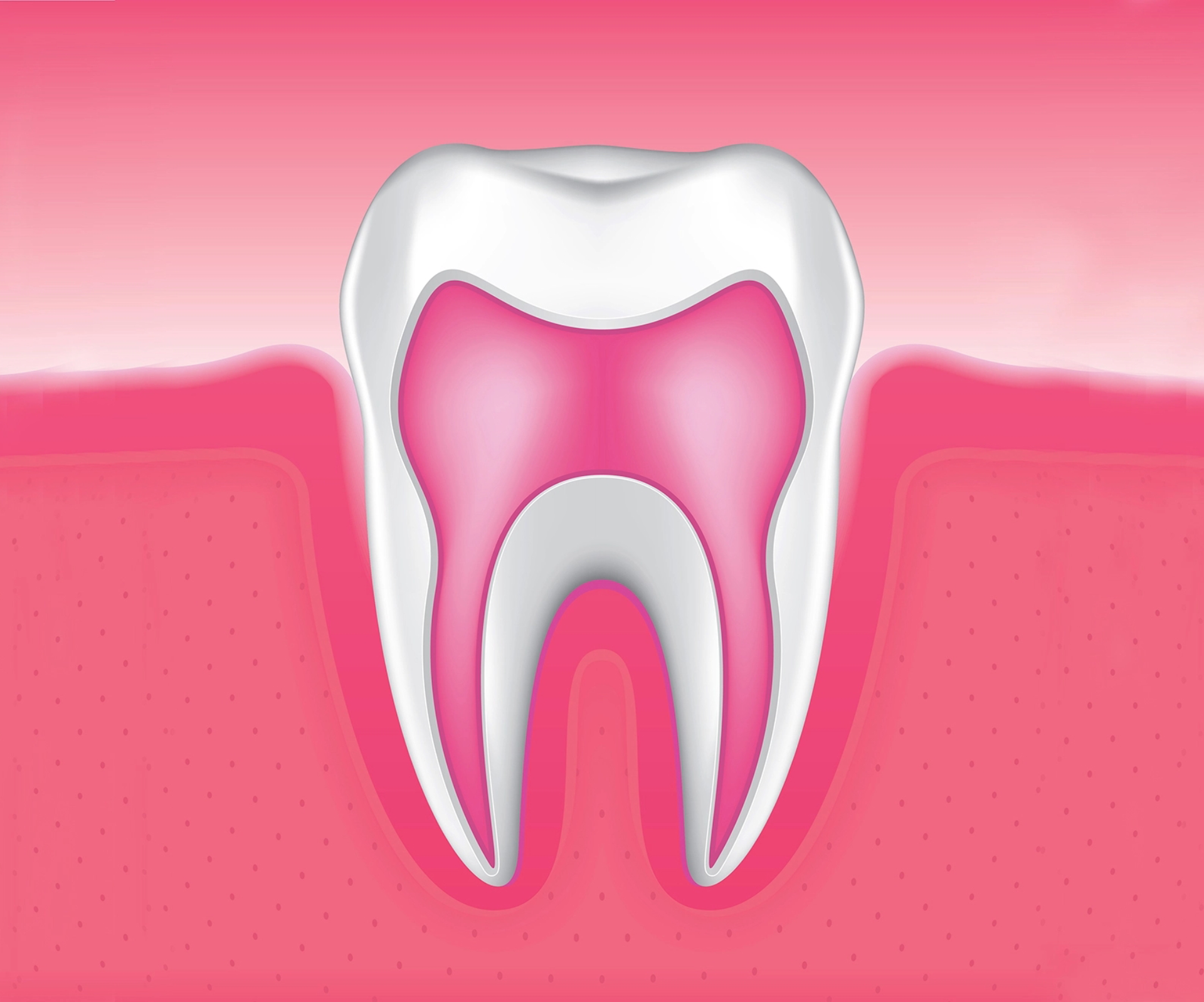 root-canal-therapy