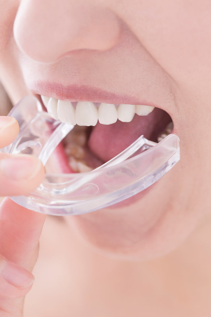 マウスピースをする女性