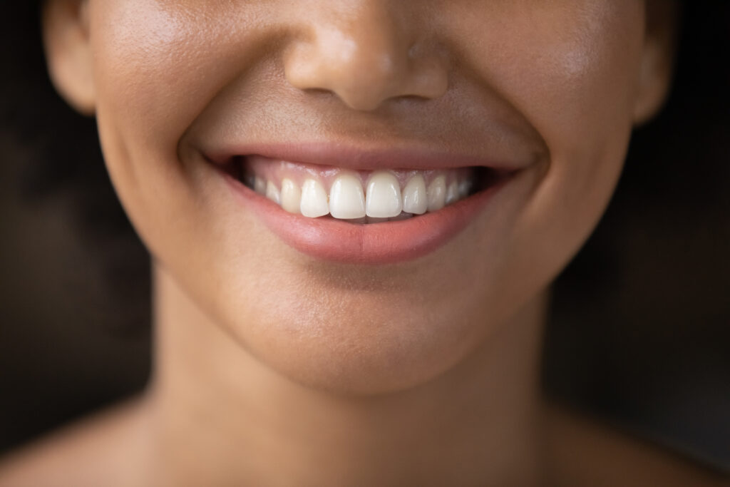 Close up happy young african american woman showing healthy smile.