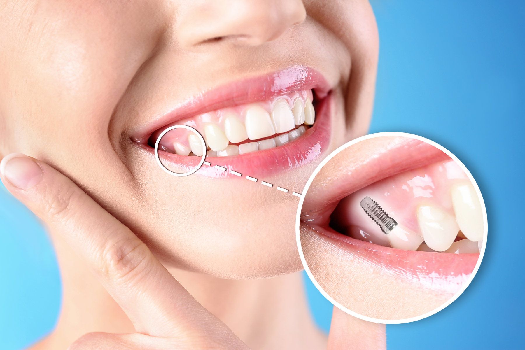 Woman with beautiful smile after dental implants procedure