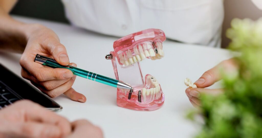 dentist implantologist showing dental implant technology on tooth jaw model to patient. visit in clinic office