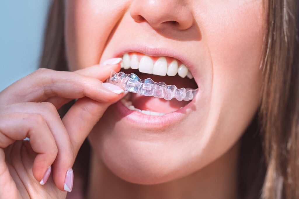 Woman smiling while holding a clear aligner tray
