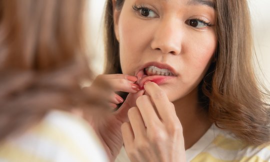 Woman examining a canker sore on her lip in the mirror, checking for signs of oral health issues