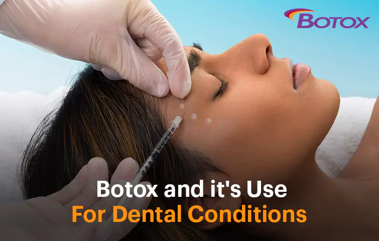 botox-and-its-use