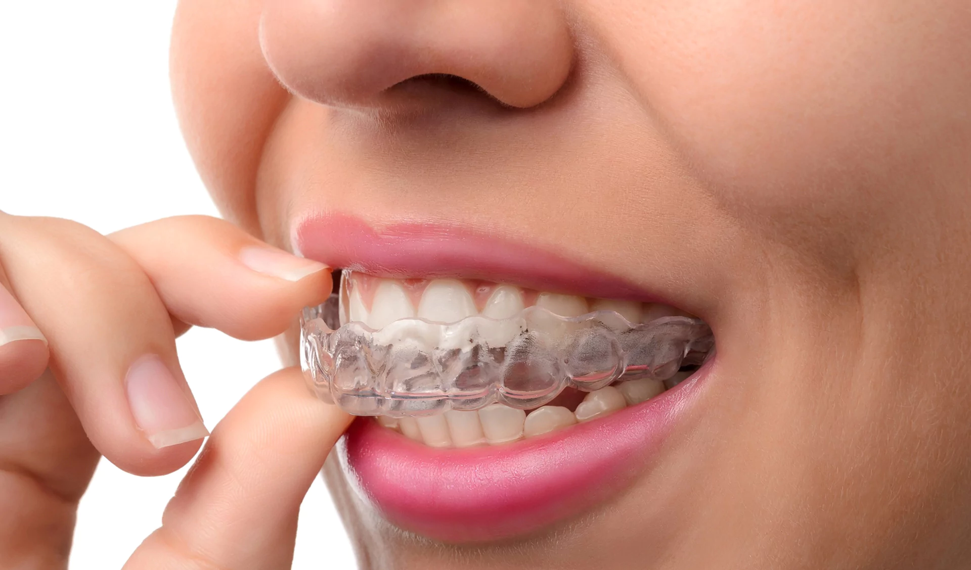 invisalign-boosts-confidence