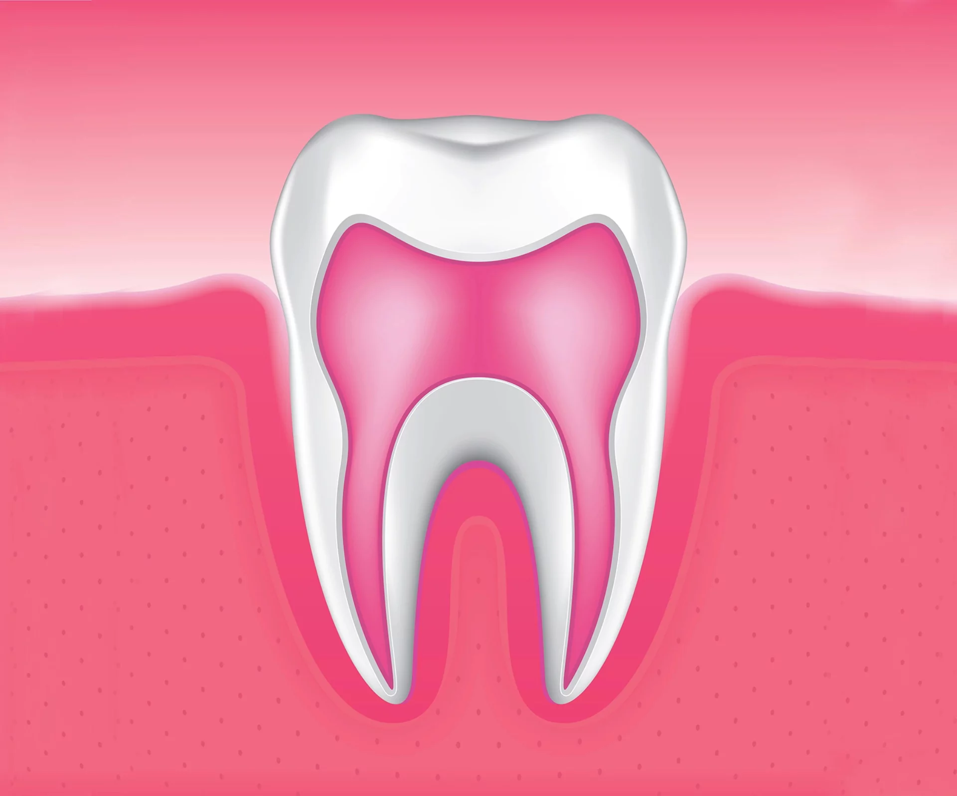 root-canal-therapy