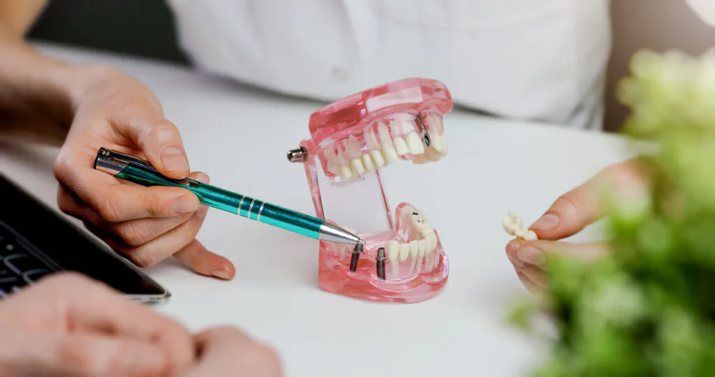 dentist implantologist showing dental implant technology on tooth jaw model to patient. visit in clinic office